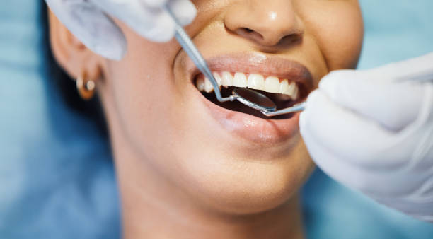 Best Emergency Wisdom Teeth Removal in Benton Harbor, MI